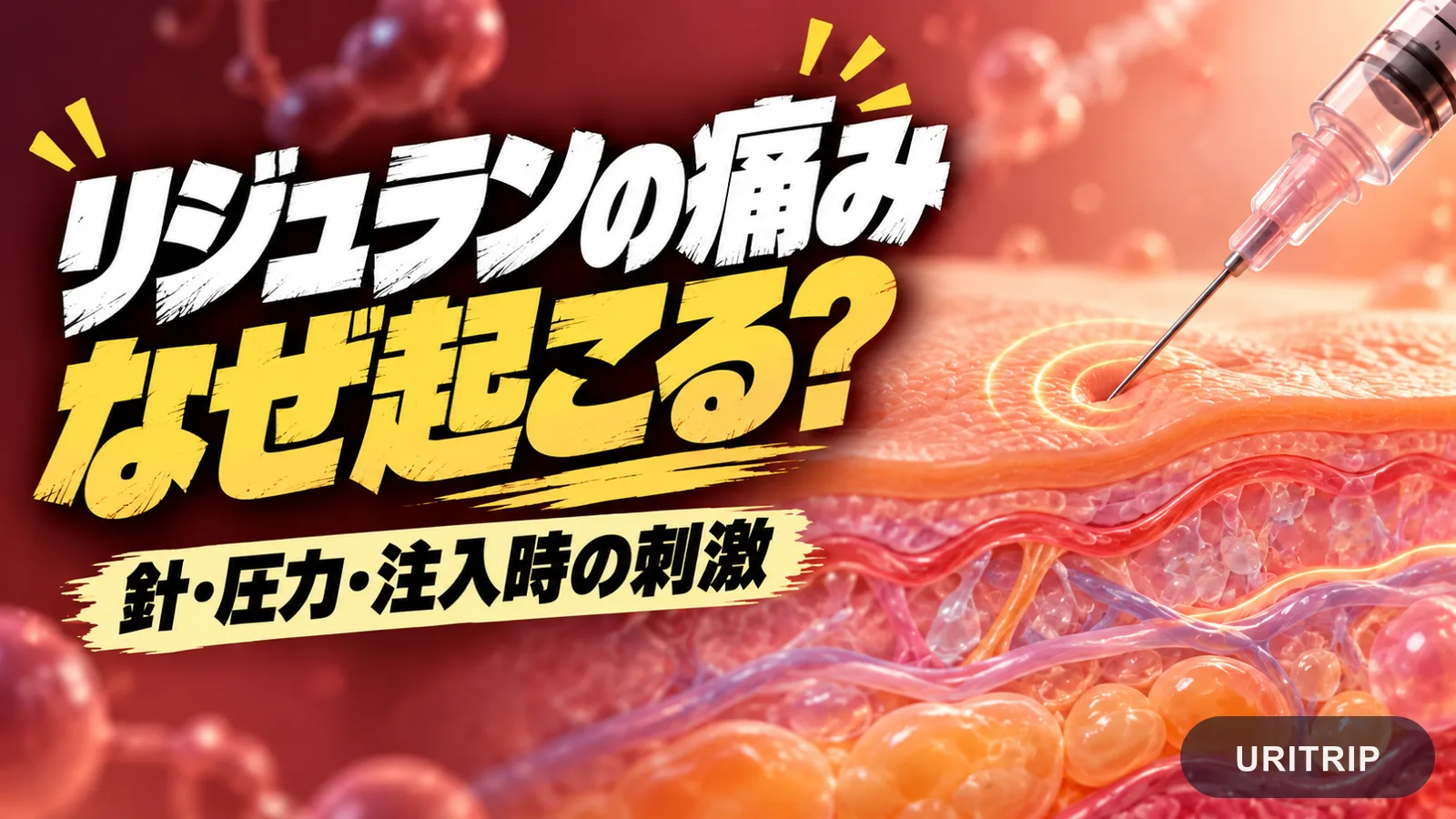 針の刺激や注入時の圧力など、リジュランの痛みに関わる要因を示したイメージ