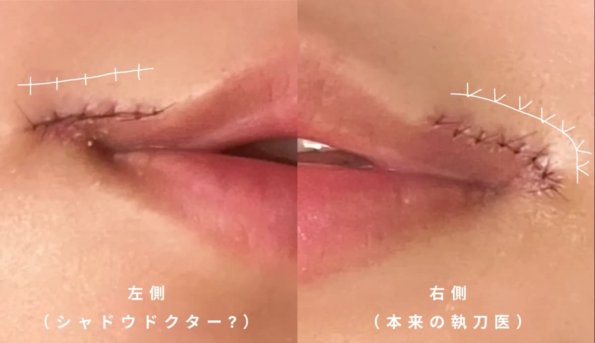 私がシャドウドクターを疑う理由