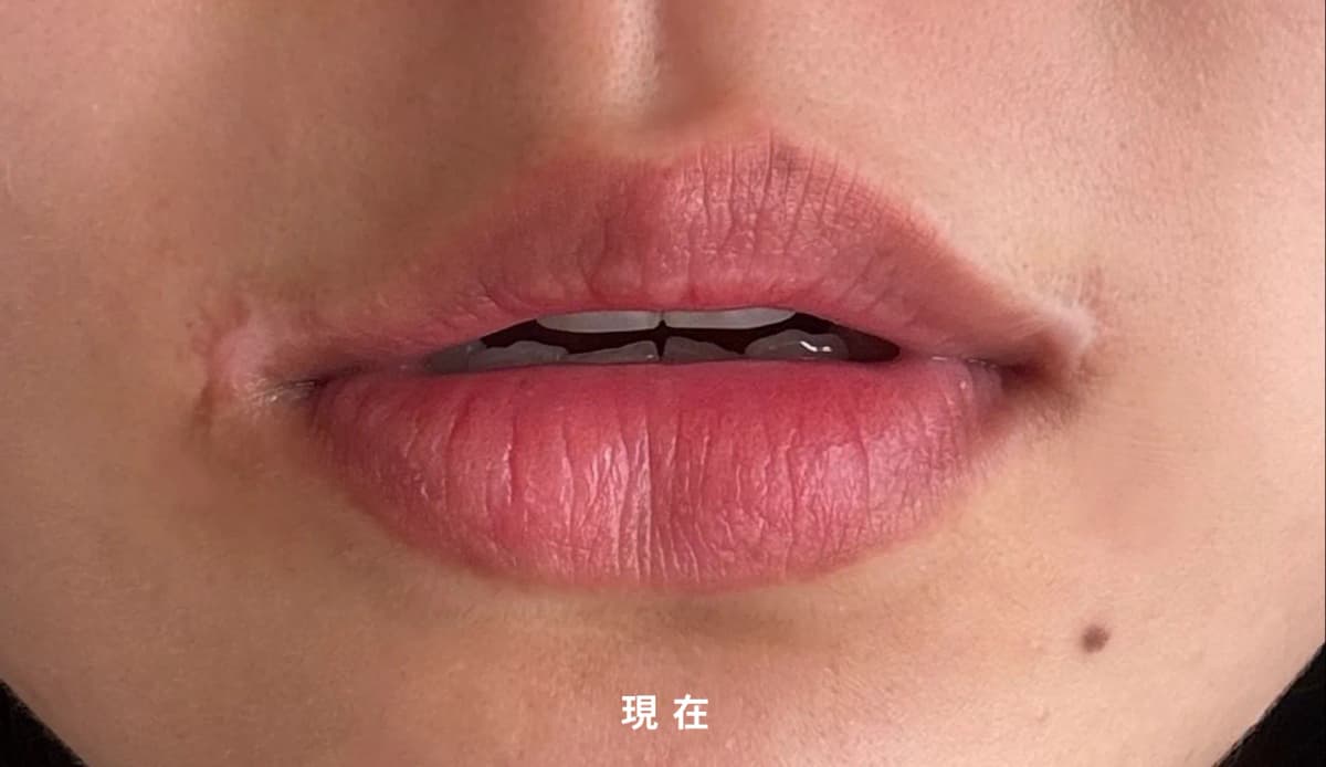 事前に確認&注意すべきこと