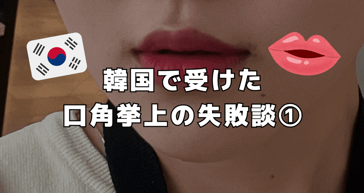 韓国で受けた口角挙上の失敗談①