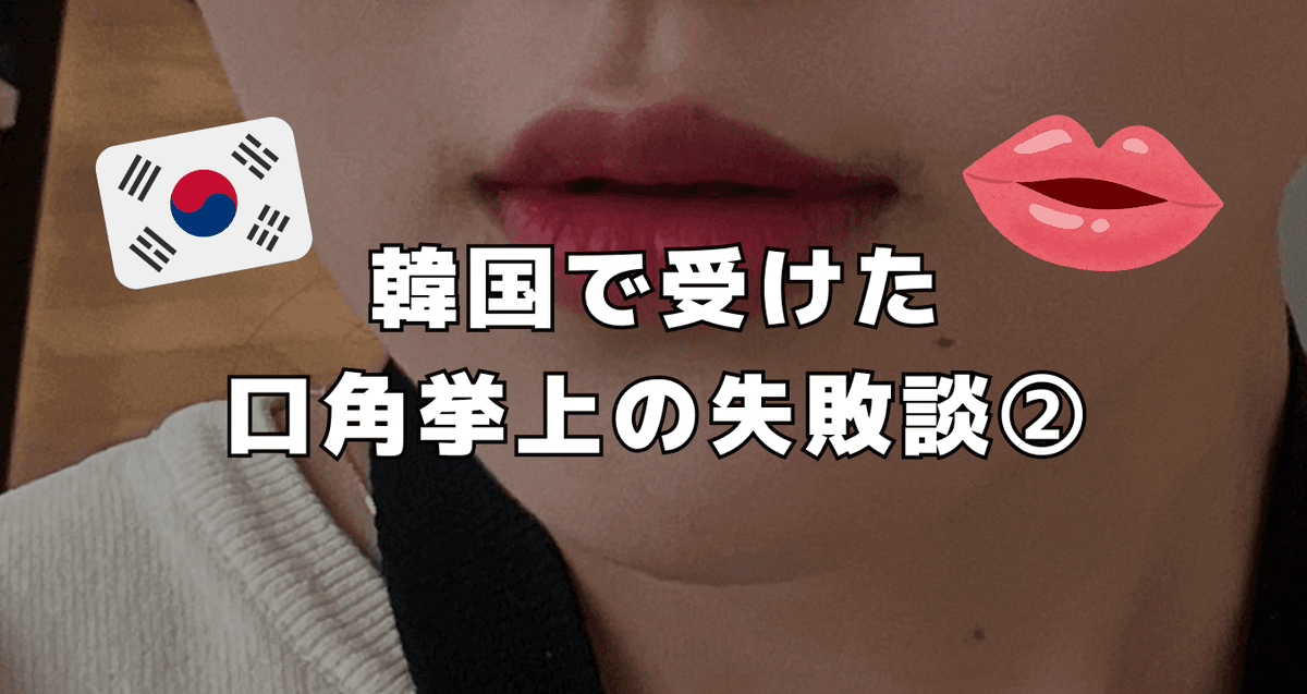 韓国で受けた口角挙上の失敗談②